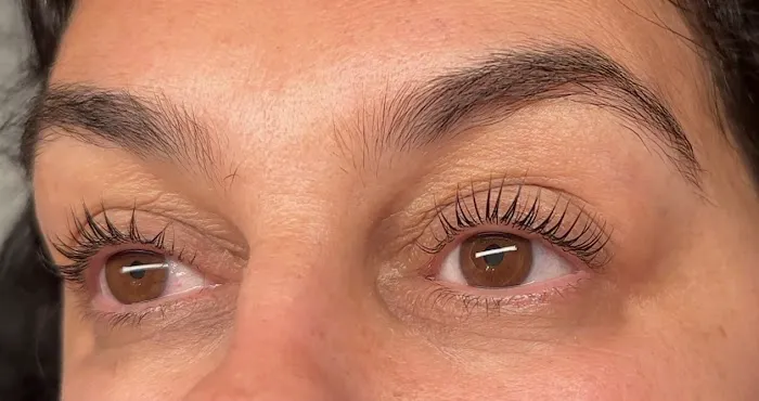 Tor esthetics Picture 1