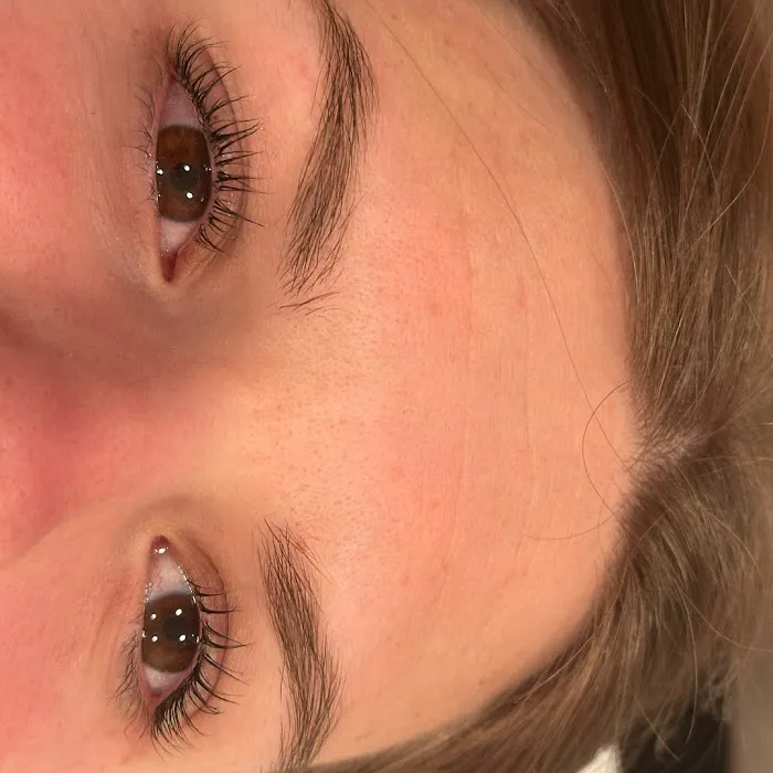 Tor esthetics Picture 2