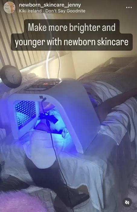 new born skin care Picture 2