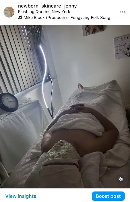 new born skin care Picture 3