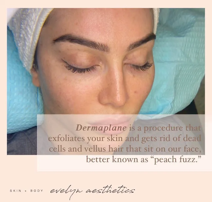 Evelyn Aesthetics Picture 4