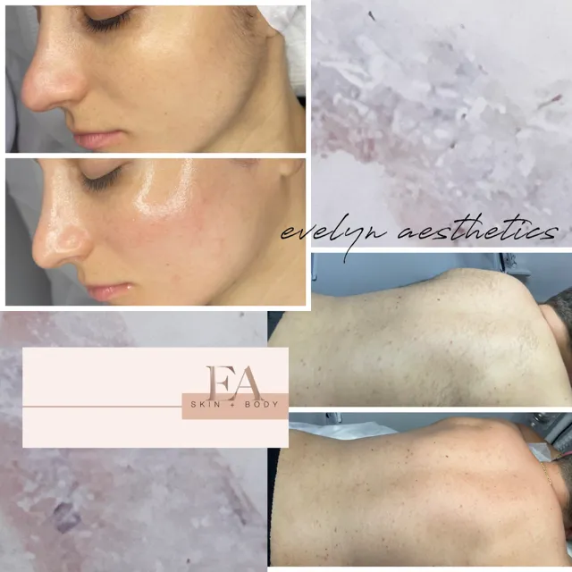 Evelyn Aesthetics Picture 6