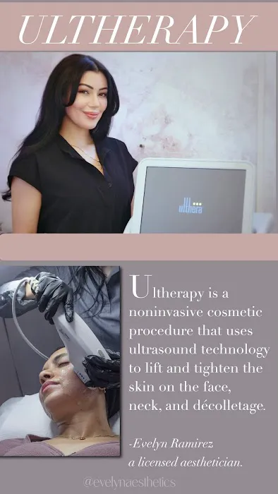 Evelyn Aesthetics Picture 9