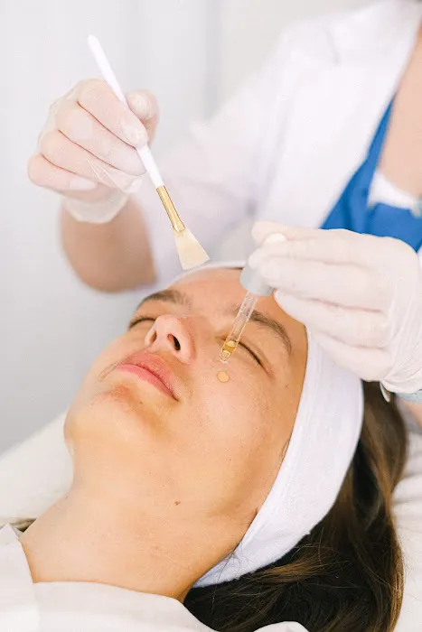 First Acne Clinic with AviClear Picture 4