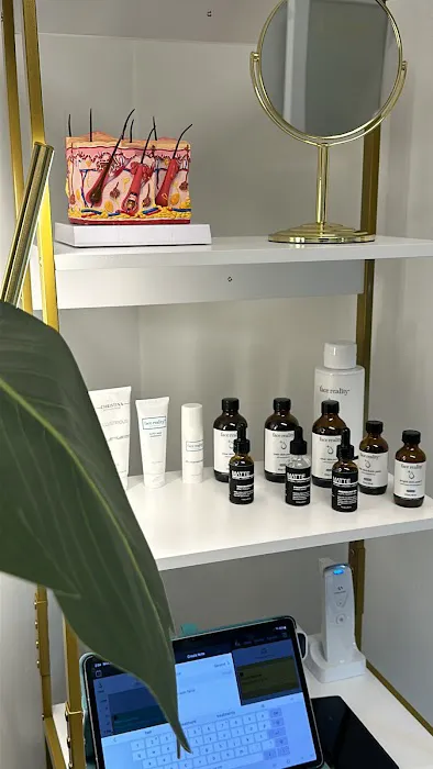 First Acne Clinic with AviClear Picture 6