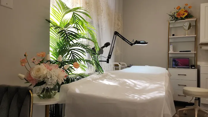 FaceLift Clinic & SPA : Fotona 4D Hyperpigmentation Melasma Picture 5