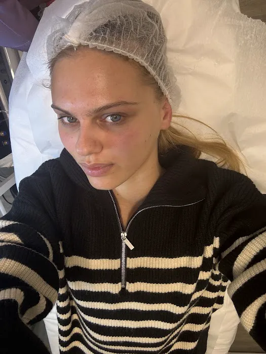 FaceLift Clinic & SPA : Fotona 4D Hyperpigmentation Melasma Picture 9