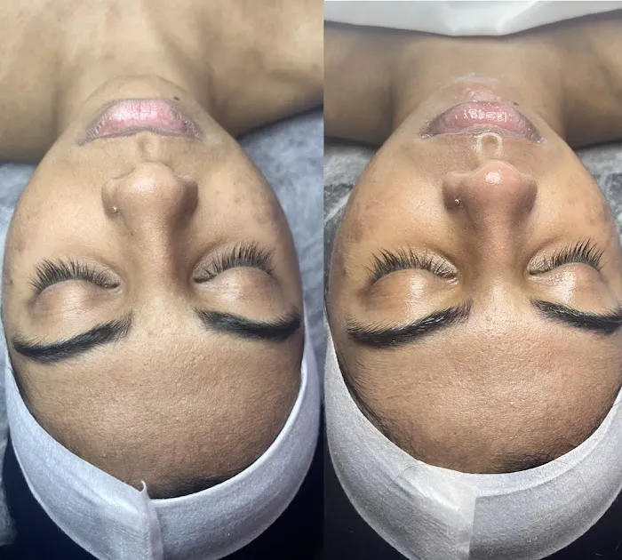 Plushe Aesthetics Picture 10