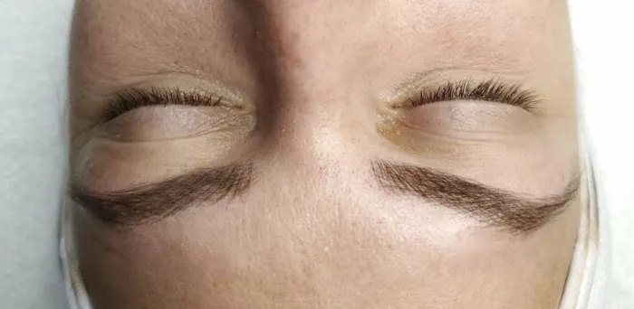 Skin Identity Picture 5