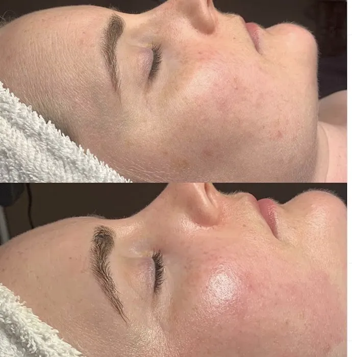 Simply Beautiful Facial Spa Picture 6