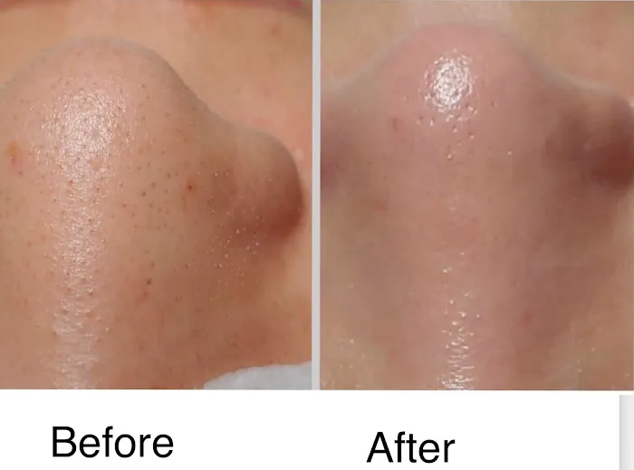 Simply Beautiful Facial Spa Picture 5