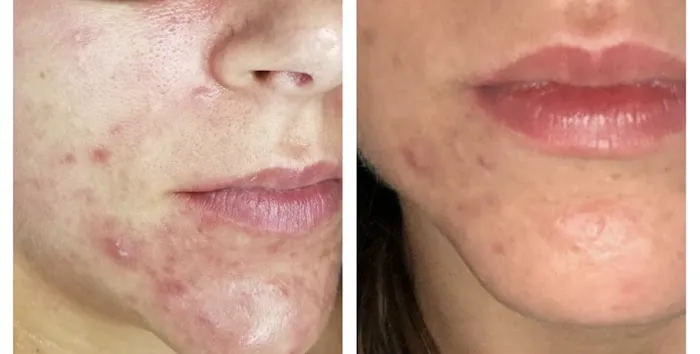 Simply Beautiful Facial Spa Picture 7