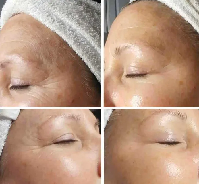 Simply Beautiful Facial Spa Picture 9