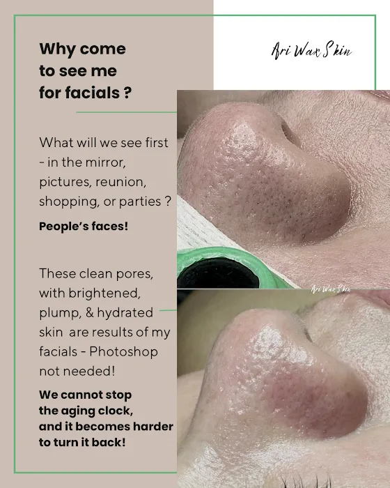 Ari Wax Skin Picture 10