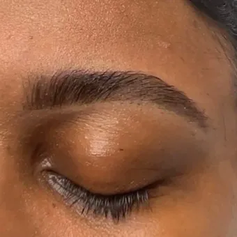 Regal Esthetics Picture 4