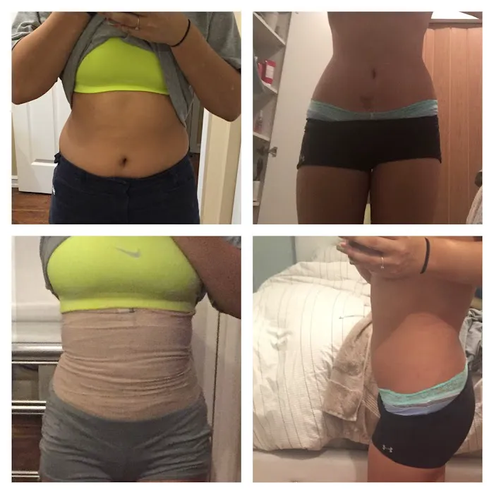 Rejuvenate Spa NY Picture 3