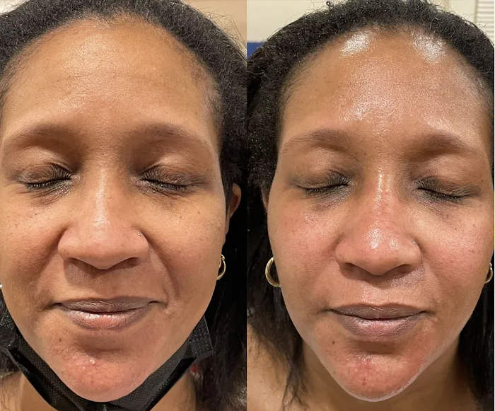 Rohanie's Skincare Picture 3