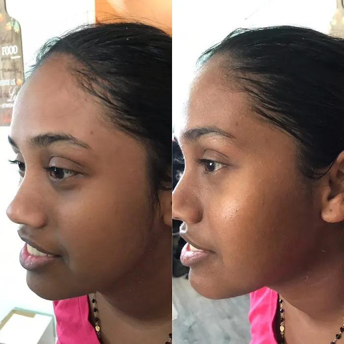 Rohanie's Skincare Picture 2