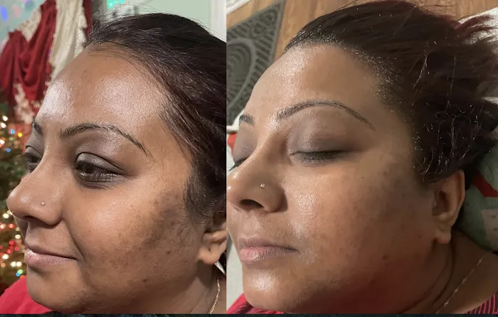 Rohanie's Skincare Picture 5