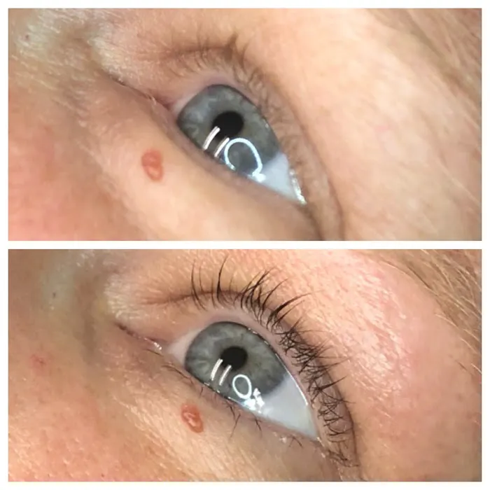 Smooth Skin Picture 2