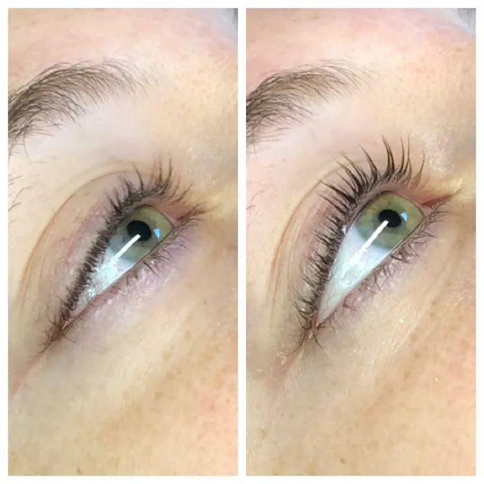 Smooth Skin Picture 6