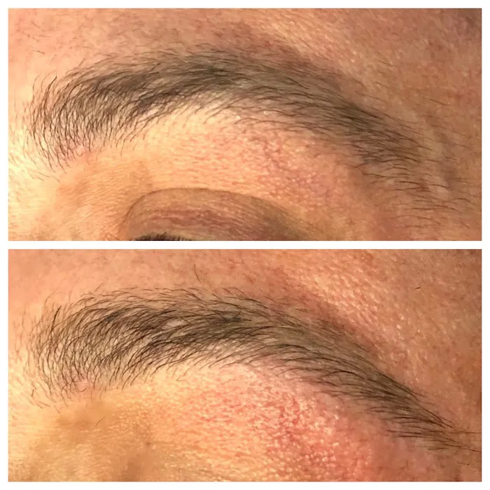 Smooth Skin Picture 5