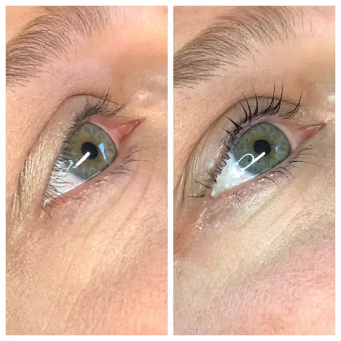 Smooth Skin Picture 4