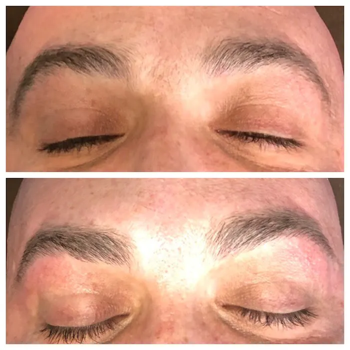 Smooth Skin Picture 3