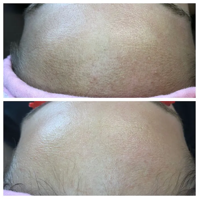 Smooth Skin Picture 9