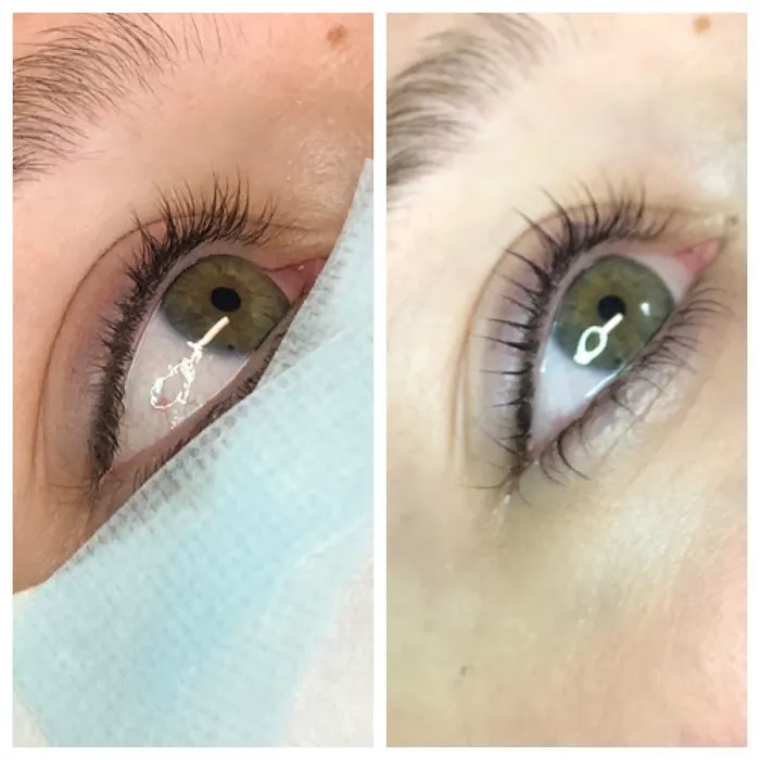 Smooth Skin Picture 7