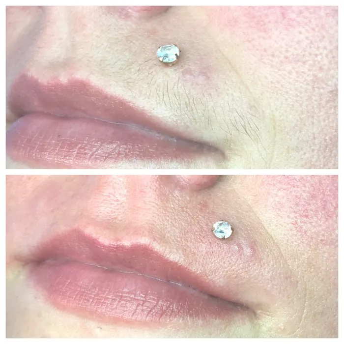 Smooth Skin Picture 8