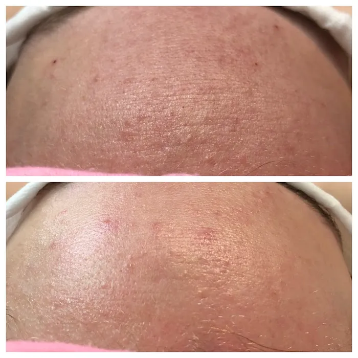 Smooth Skin Picture 10