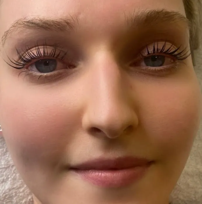 On The Glow Picture 10