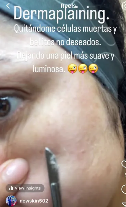 New Skin Llc. Picture 9