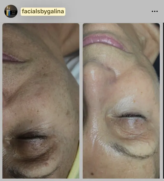FacialsbyGalina LLC Picture 3