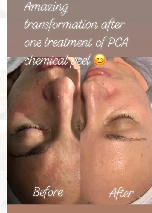 FacialsbyGalina LLC Picture 8