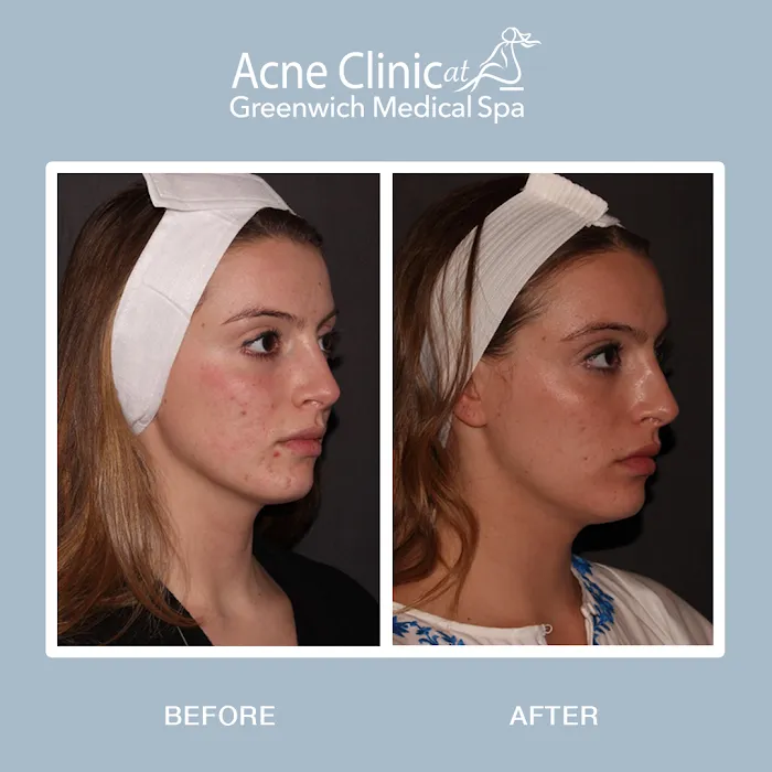 The Acne Clinic at Greenwich Medical Spa Westport Picture 6