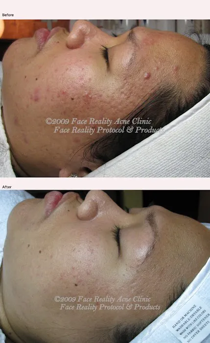 The Acne Clinic at Greenwich Medical Spa Westport Picture 4