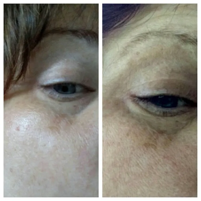 Simply Smooth Skin LLC Picture 1