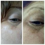 Simply Smooth Skin LLC