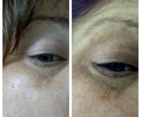 Simply Smooth Skin LLC