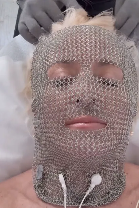 Lumina Laser Beauty | Hair Loss | Hair regrowth | Laser Facial Hair Removal in Arlington Picture 4