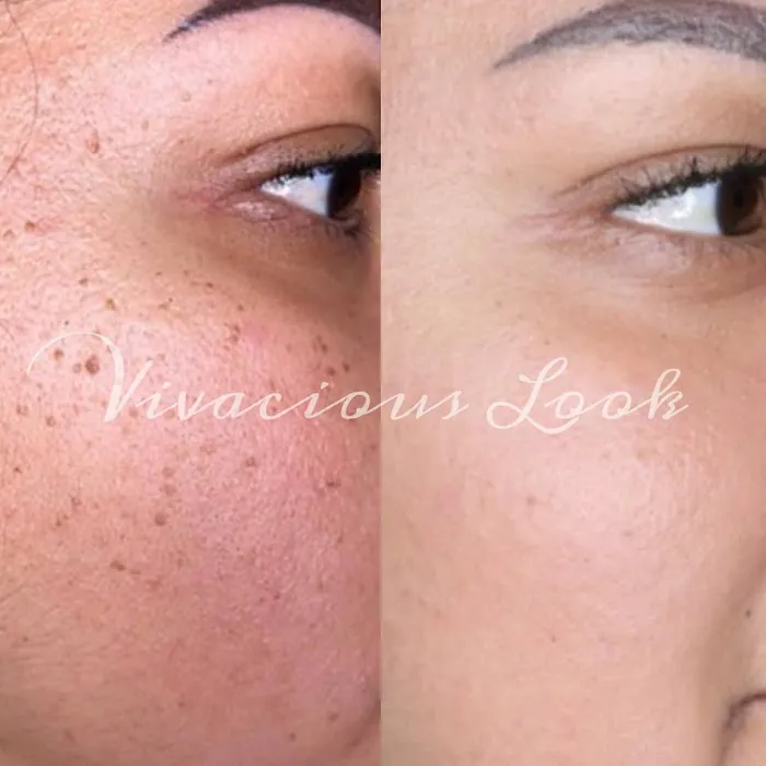 Vivacious Look Picture 6