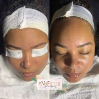No Filter Skin and Beauty LLC ico