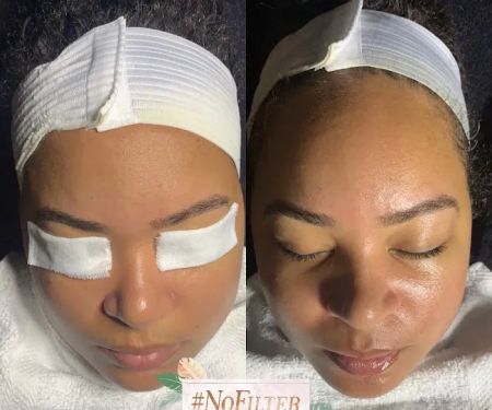 No Filter Skin and Beauty LLC