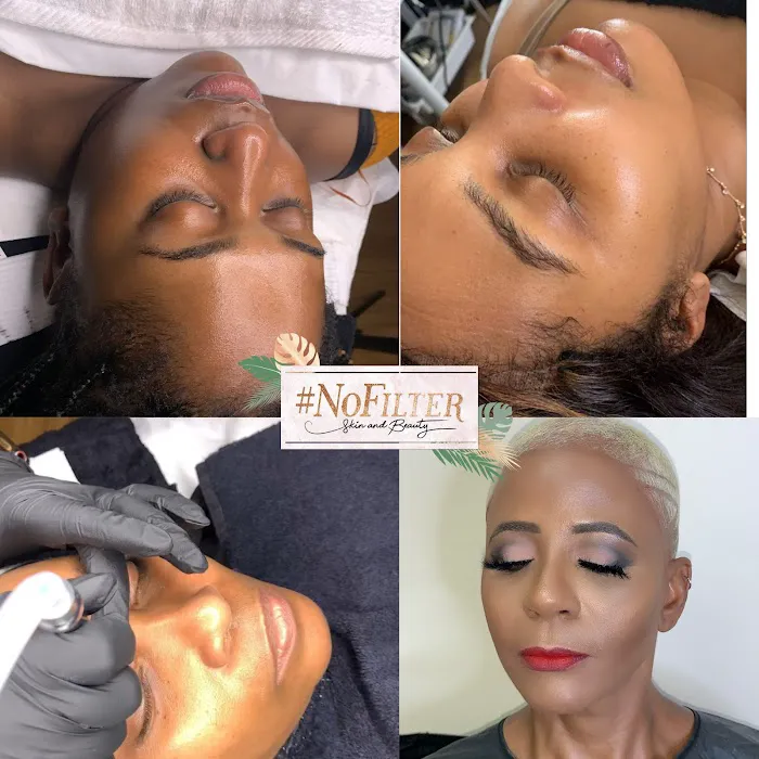 No Filter Skin and Beauty LLC Picture 5