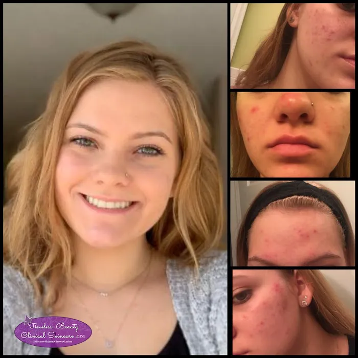 Timeless Beauty Clinical Skincare LLC Picture 10