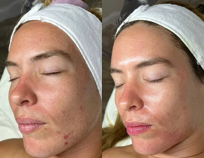 Sabrina Skin Picture 2