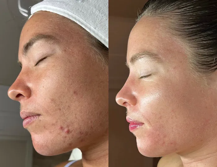 Sabrina Skin Picture 8