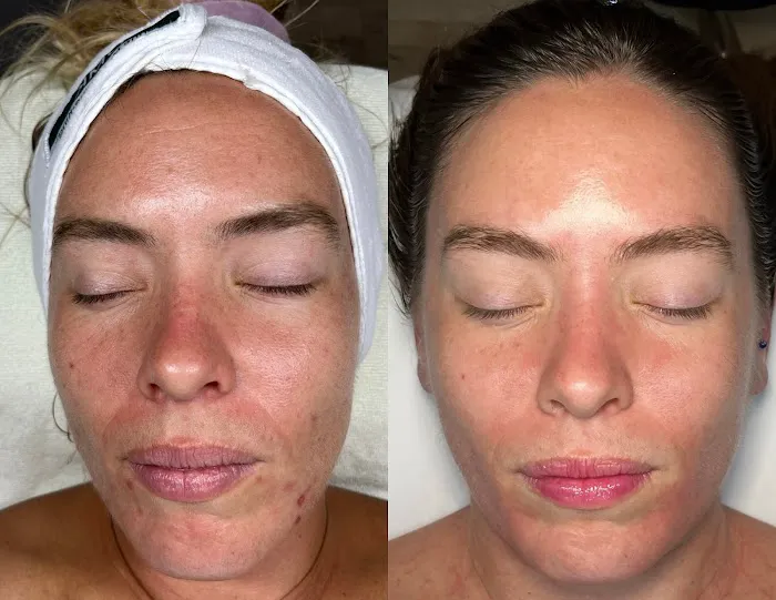 Sabrina Skin Picture 1